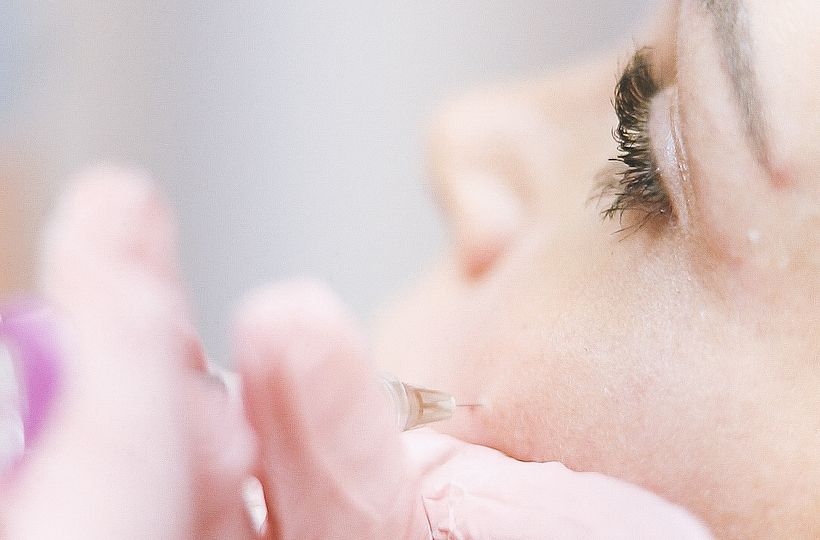 Armonización facial